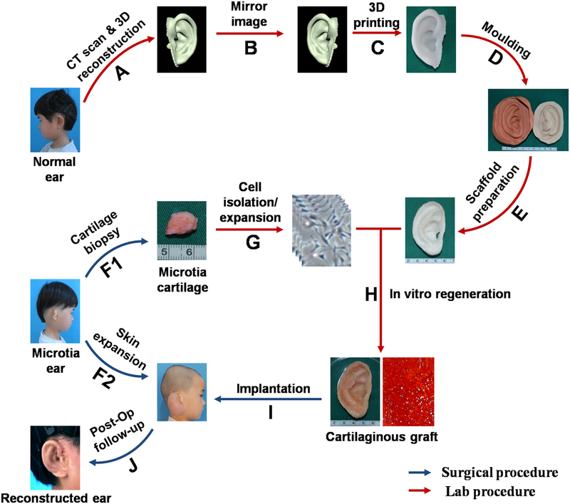 The lengthy process behind the procedure, illustrated above. Image: Cao et al/EBioMedicine